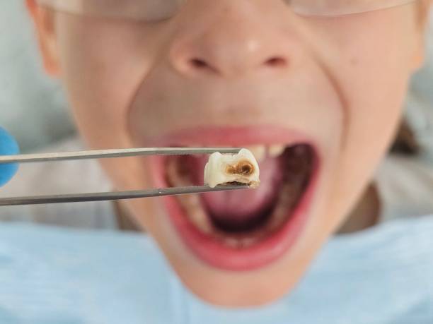 Best Weekend Emergency Dental Services in Logansport, LA